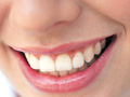 implantes dentais